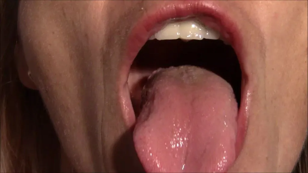 thumbnail foto nr. 7 von Für Peter, Mundfotze