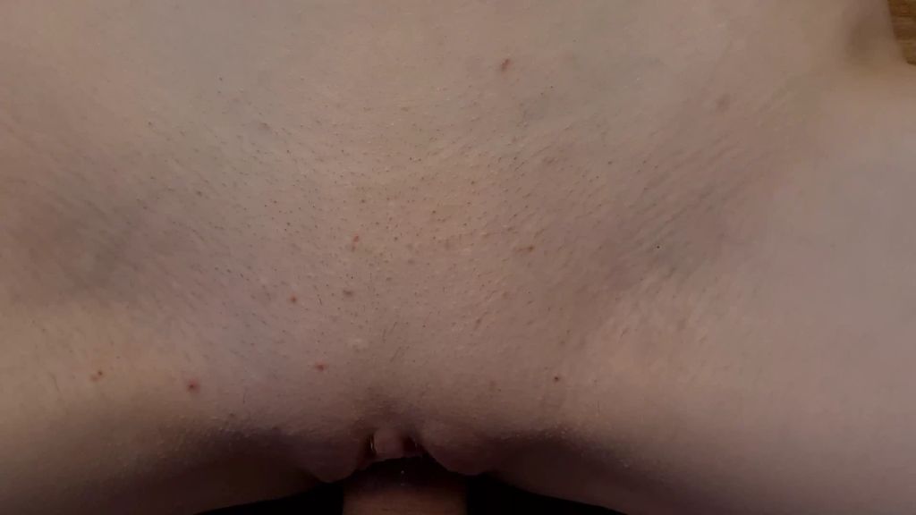 sexy foto nr. 8 von Dreist!!! Er täuscht Verletzung vor für Mitleidsfick